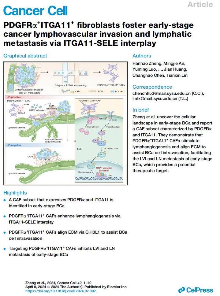 研究揭示早期膀胱癌脈管癌栓形成的關鍵分子機制 研究揭示早期膀胱癌脈管癌栓形成的關鍵分子機制