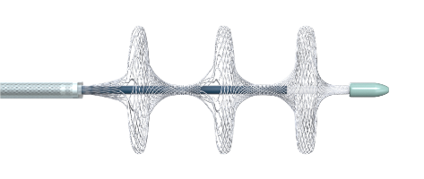 國內(nèi)首創(chuàng)!本市研發(fā)生產(chǎn)的1款Ⅲ類創(chuàng)新醫(yī)療器械獲批上市,為具有溶栓禁忌癥的患者提供了治療選擇 國內(nèi)首創(chuàng)!本市研發(fā)生產(chǎn)的1款Ⅲ類創(chuàng)新醫(yī)療器械獲批上市,為具有溶栓禁忌癥的患者提供了治療選擇